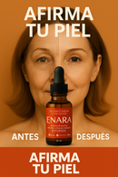 Aceite Corporal Enara™ - Rejuvenezca su piel hasta 15 años